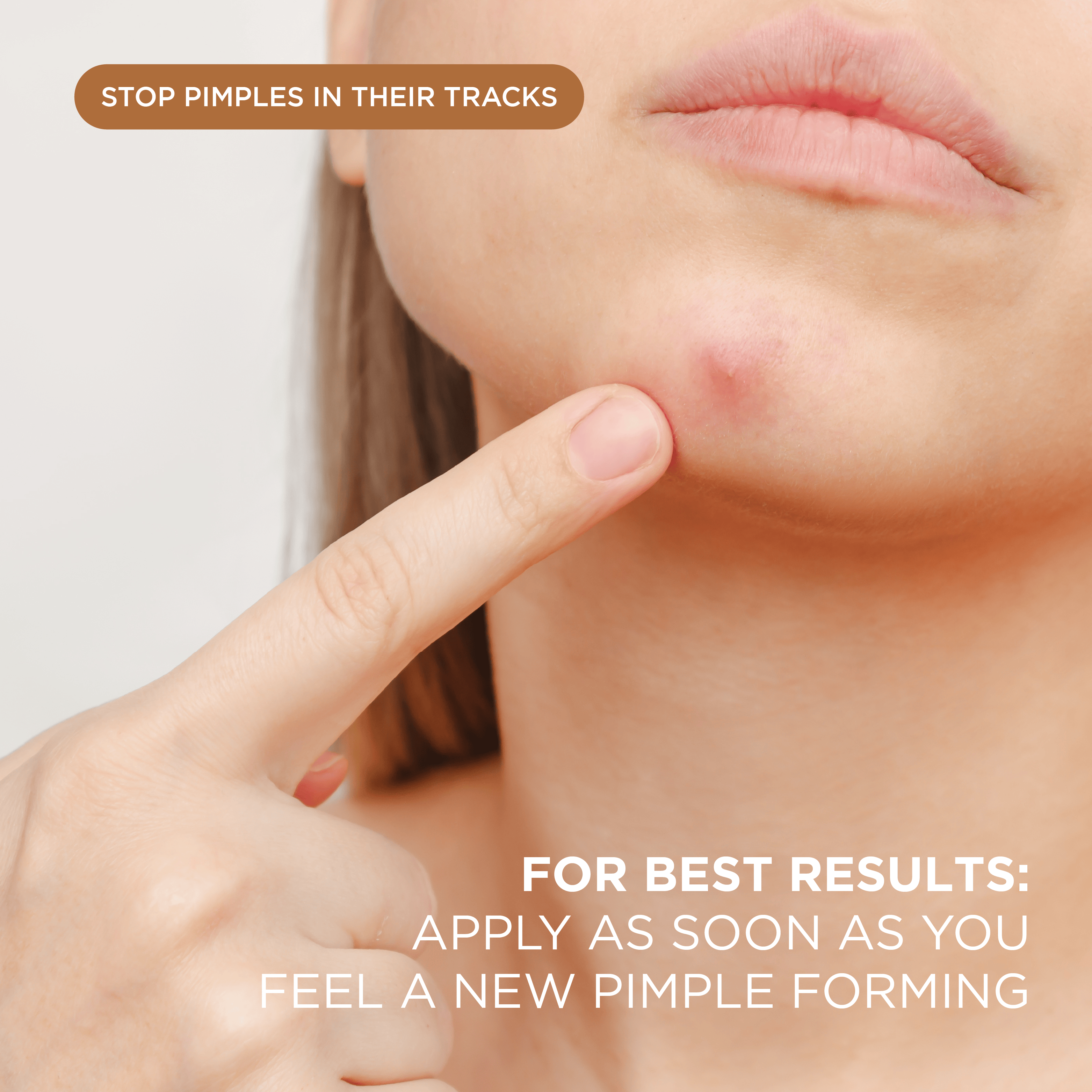 NIGHT Duplicate 48 Count Advanced Pimple Patches, 48 Ct