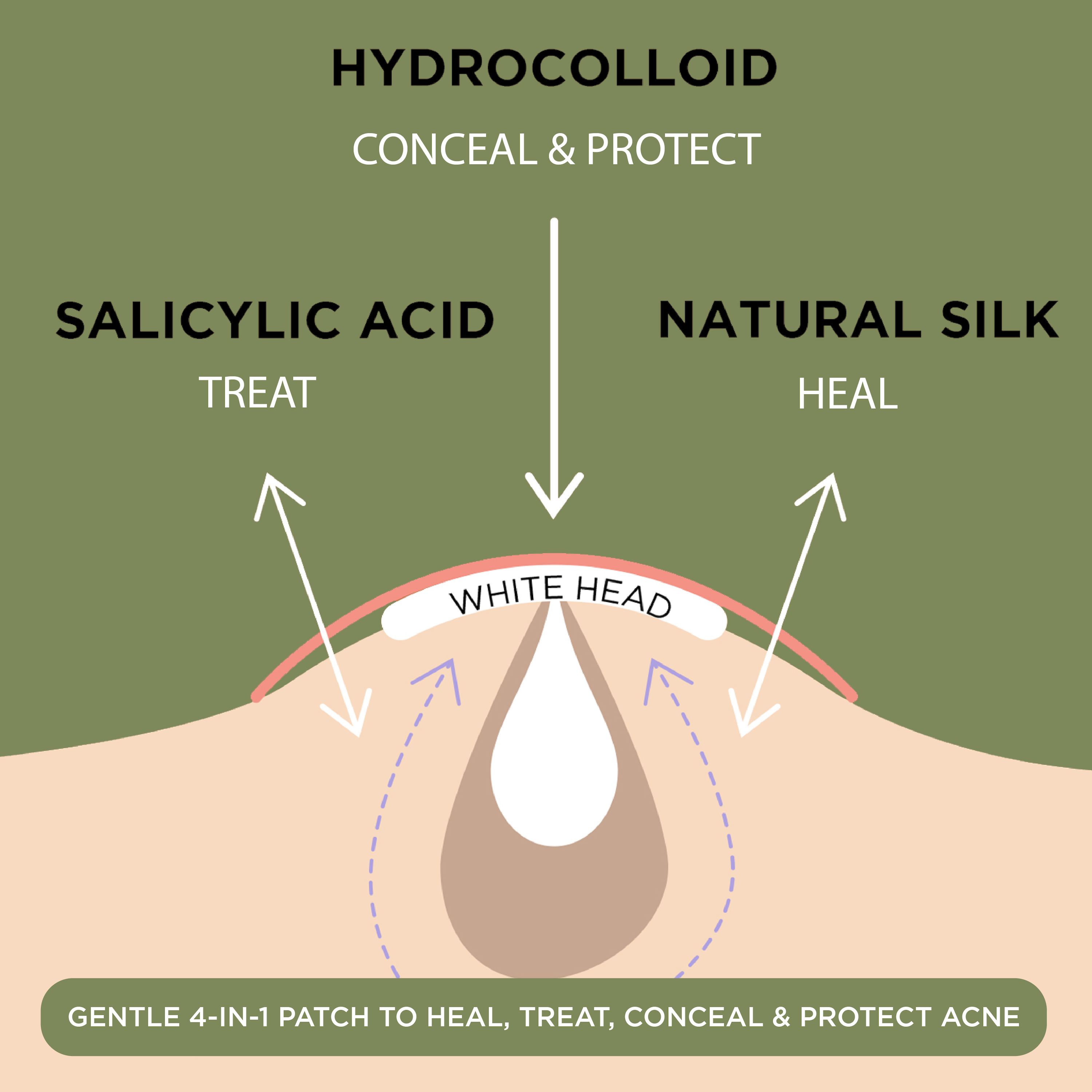 NIGHT Duplicate Everyday Pimple Patches, Ultra Value Pack, 224 Ct