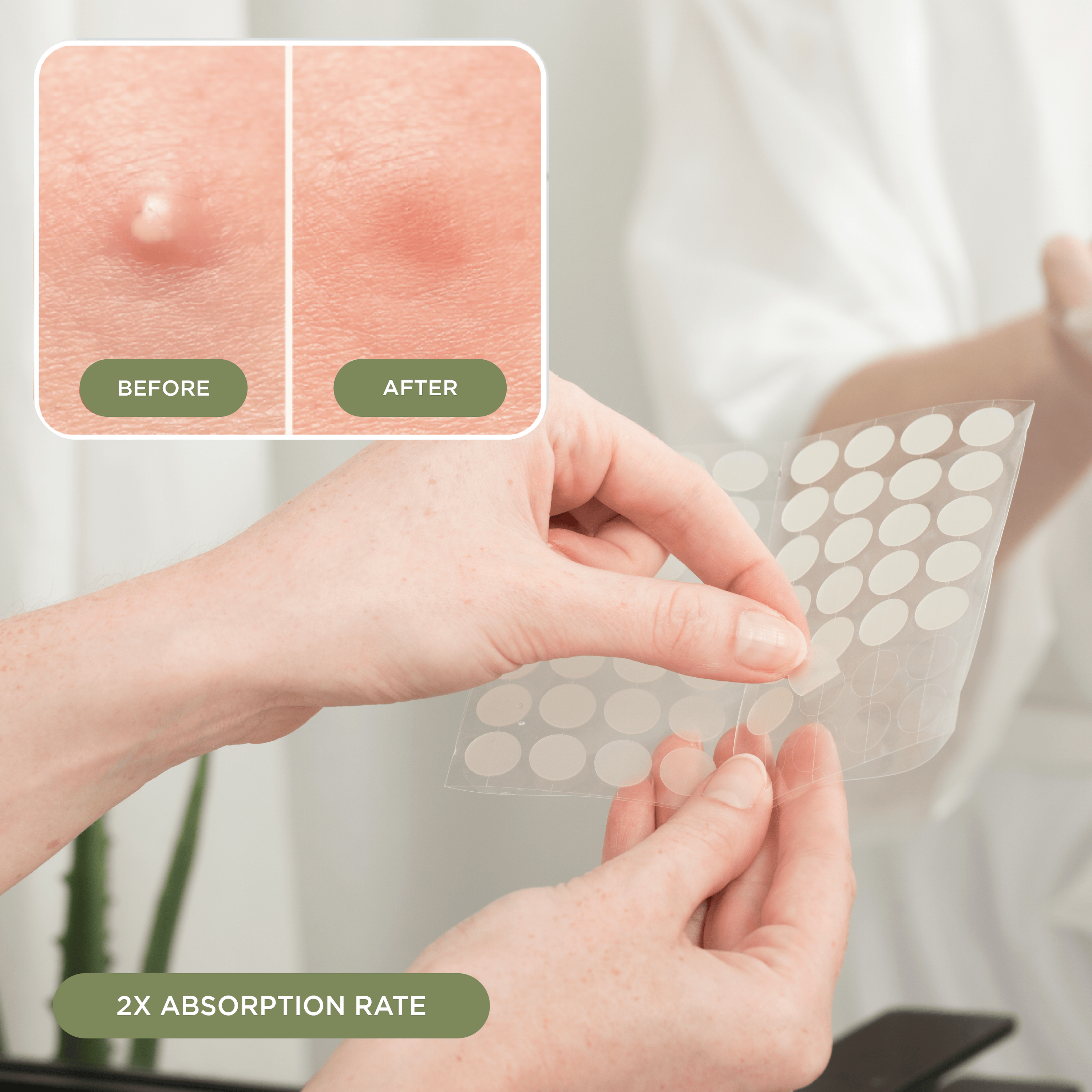 NIGHT Duplicate Everyday Pimple Patches, Ultra Value Pack, 224 Ct