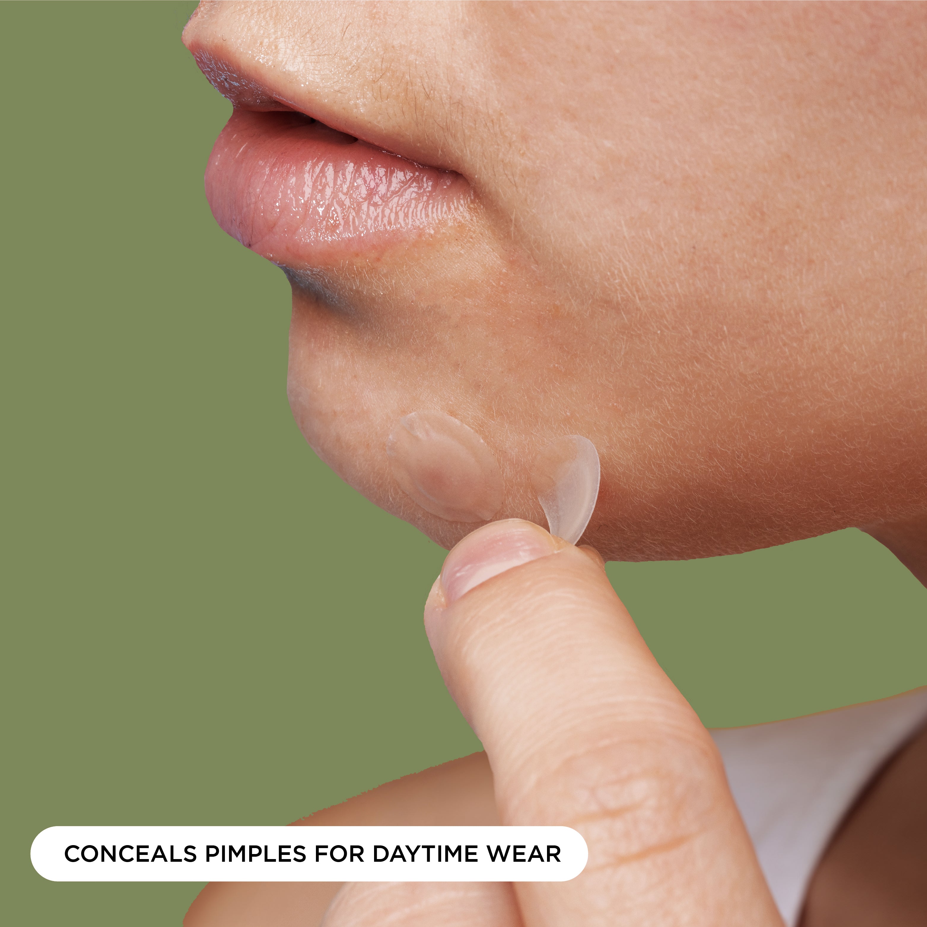 NIGHT Duplicate Everyday Pimple Patches, Ultra Value Pack, 224 Ct