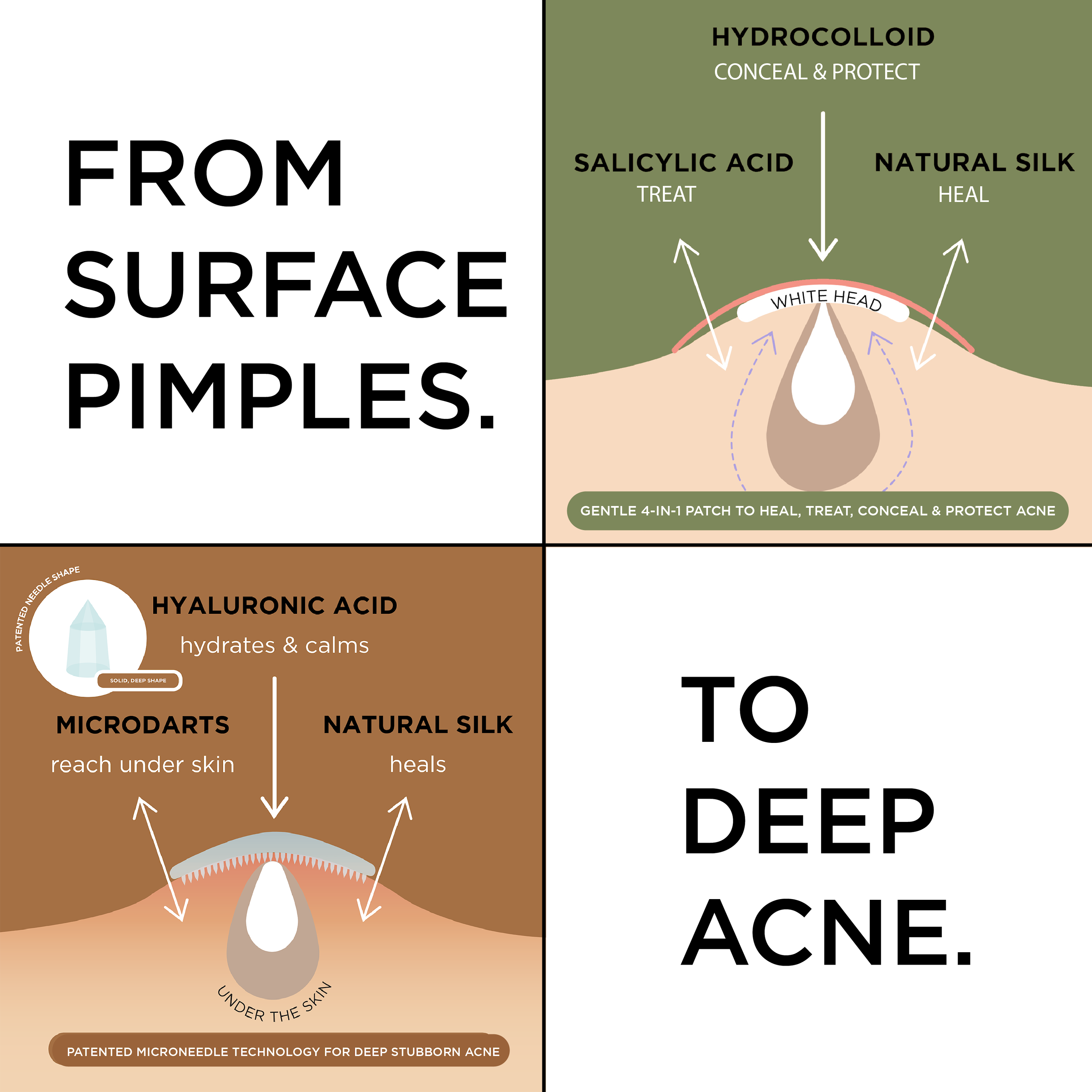 NIGHT Duplicate 272pk Pimple Patch Duo, Everyday & Advanced, 272 Ct