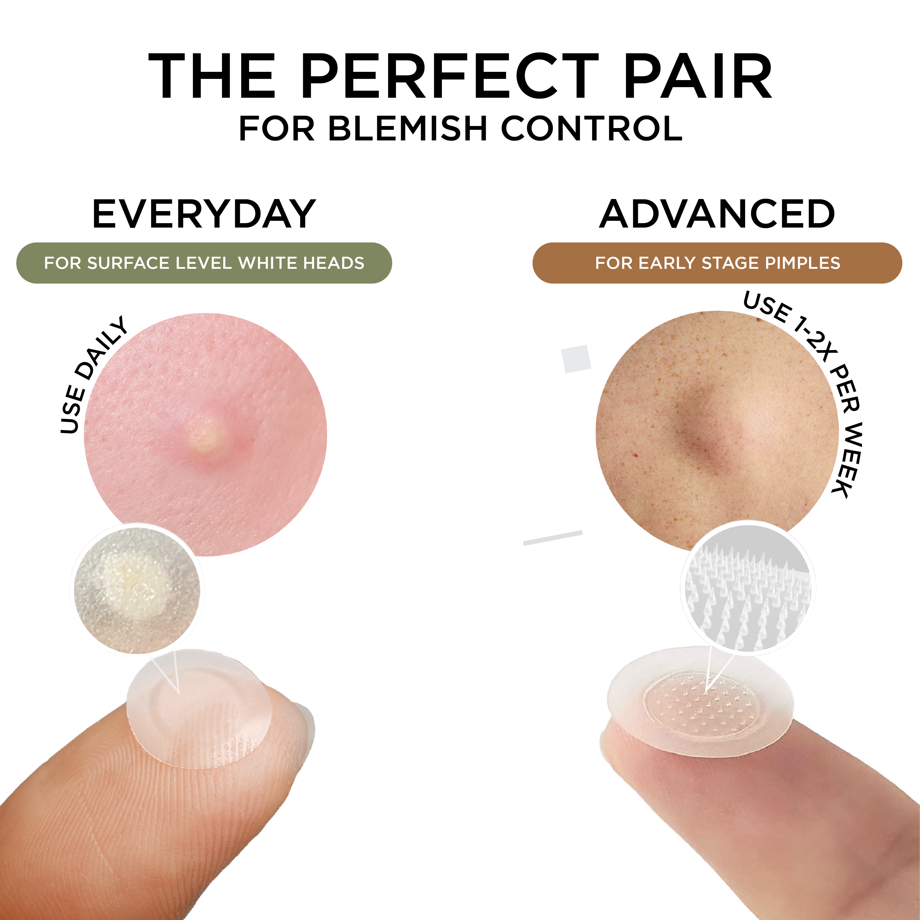 NIGHT Duplicate 272pk Pimple Patch Duo, Everyday & Advanced, 272 Ct