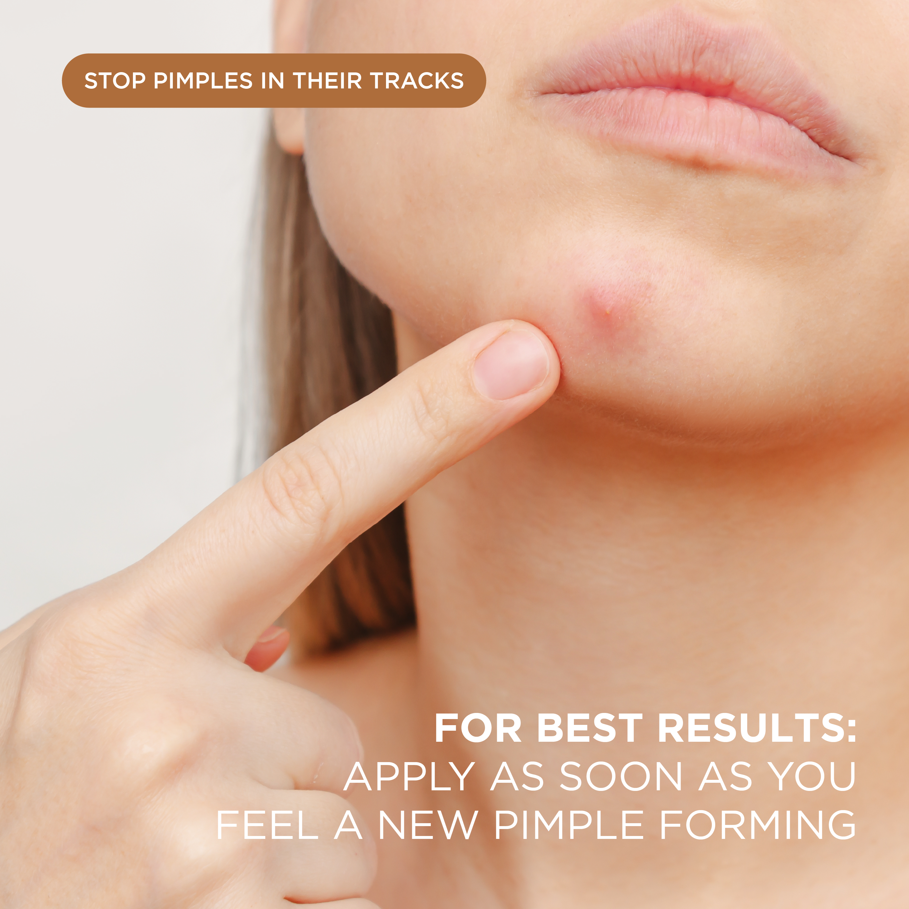 NIGHT Duplicate 48 Count Advanced Pimple Patches, 48 Ct