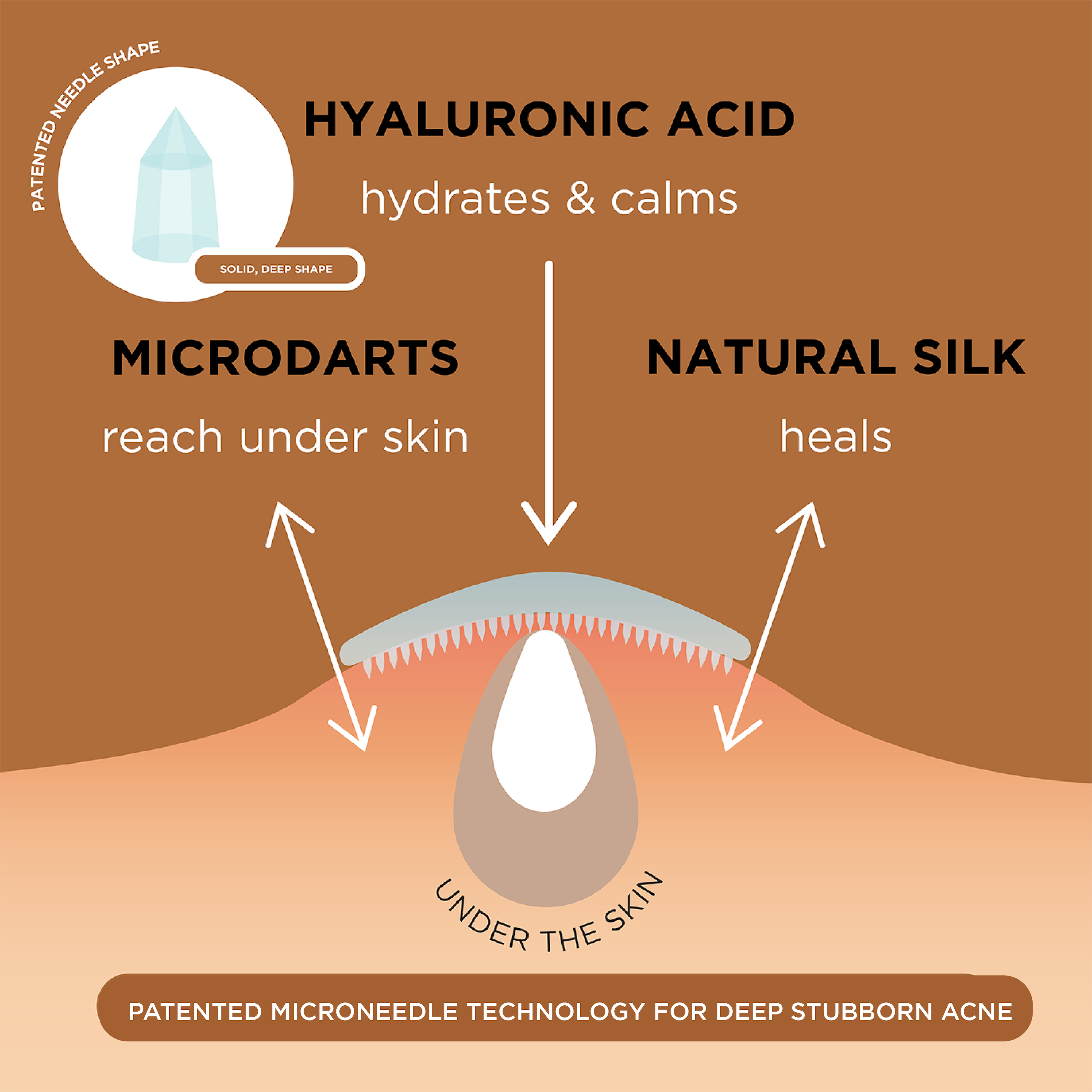 NIGHT Duplicate 48 Count Advanced Pimple Patches, 48 Ct